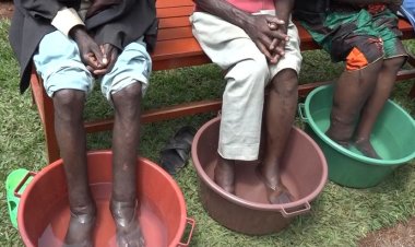 Nyamasheke : Amashimwe y'abarwayi b'imidido bavuwe bagakira