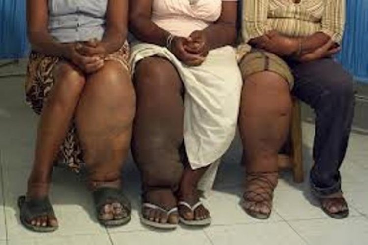 Hari abaturage bavuga ko batazi ibijyanye n'indwara y'imidido uko yandura ndetse n’uko bayivuza