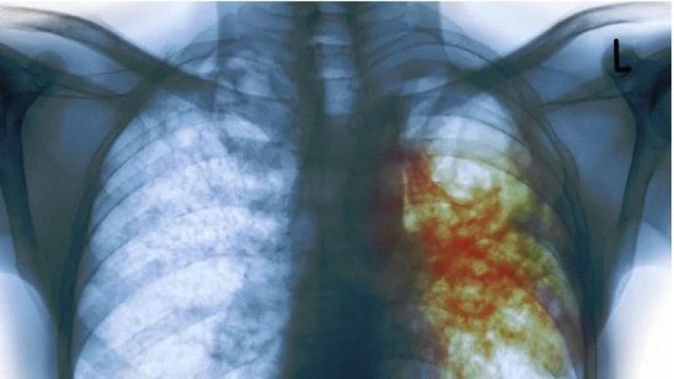 Imyumvire, kutagira amakuru: zimwe mu mpamvu zituma igituntu kidacika.