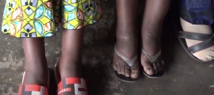 Inzego z’ibanze zirasabwa kugira uruhare mu kwita ku ndwara zititaweho nk’imidido.