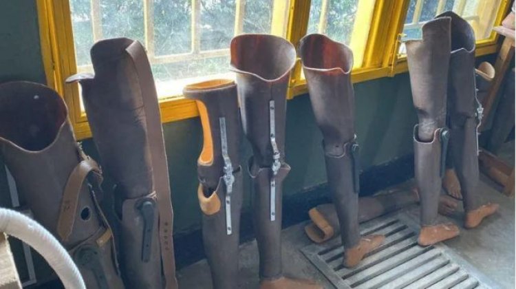 Abafite ubumuga bw’ingingo barasaba koroherezwa  kubona insimburangingo zigezweho.