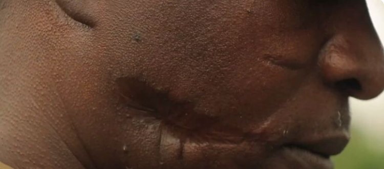 Nyabihu-Bigogwe: Barinubira gukubitwa n’abayobozi