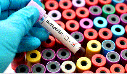 The Hemophilia Disease Troubling Health Institutions in Rwanda