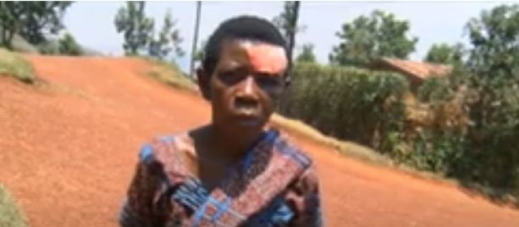 Kigali- Jali: Barasabira ubutabera umuturage wakubitiwe mu nteko y'abaturage