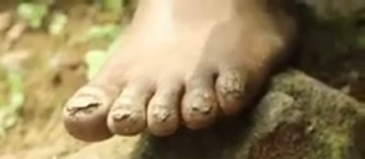 MUSANZE: Barataka kurogwa amavunja akagera no mu myanya y’ibanga