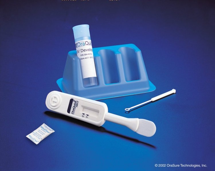 Urubyiruko rurasaba ubukangurambaga ku buryo bwo kwipima SIDA