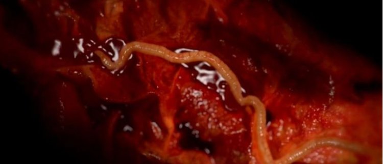 Rubavu: Baretse gukoresha ifumbire yo mu musarani bigabanya umubare w’abarwara inzoka